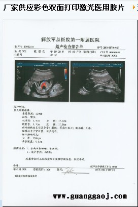 2012A4透明PVC胶片 PET 装订封面 装订胶片 透片210*297  13丝图3